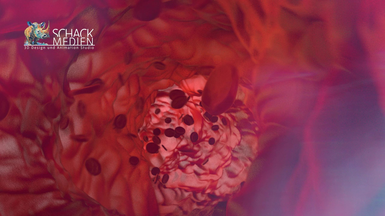 Vorschaubild: Medizinische 3D-Visualisierung von roten Blutkörperchen