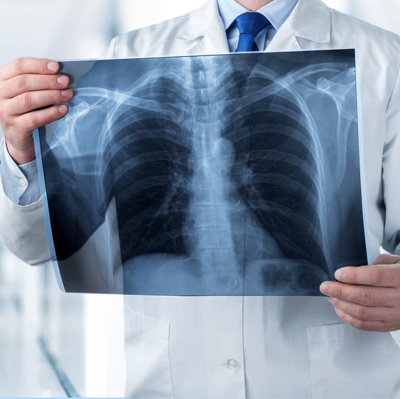 radiologist holding xray