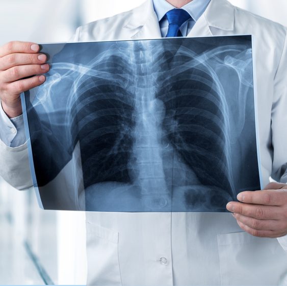 radiologist holding xray